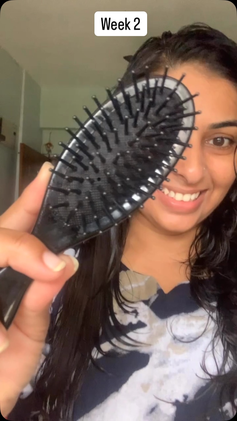 Instagram post by @ugc_booms_10 for WishCare. Caption reads: Hairfall ne confidence tod diya tha 💔 But then I....