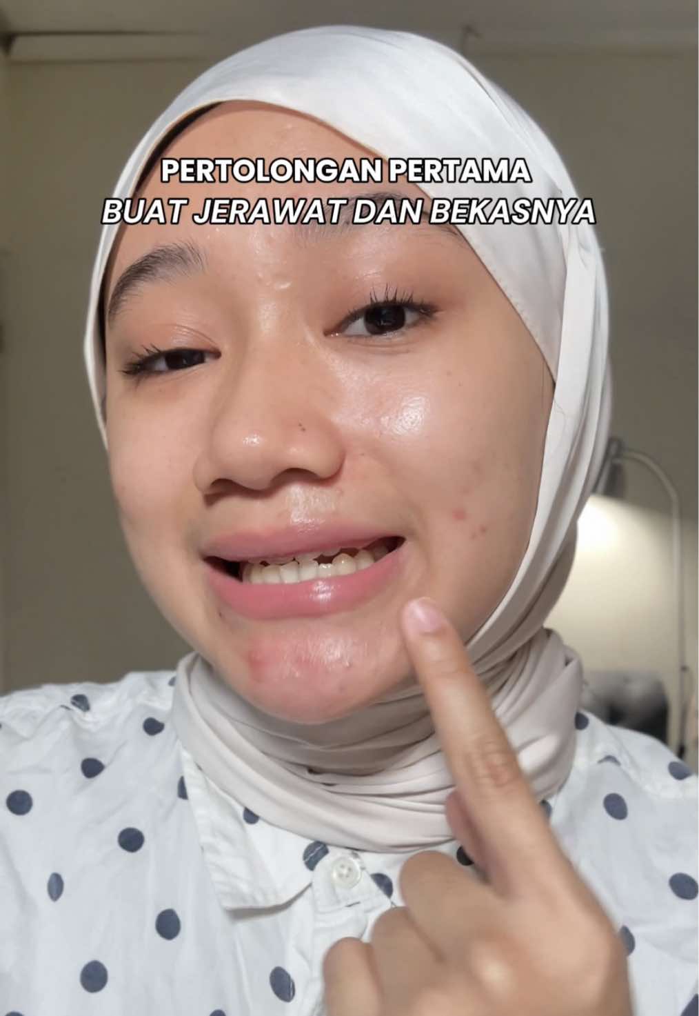 TikTok post by @maritzazhrsy for Nurilab.id. Caption reads: [...] #SerumConcealer #ObatJerawat @Nurilab.id.