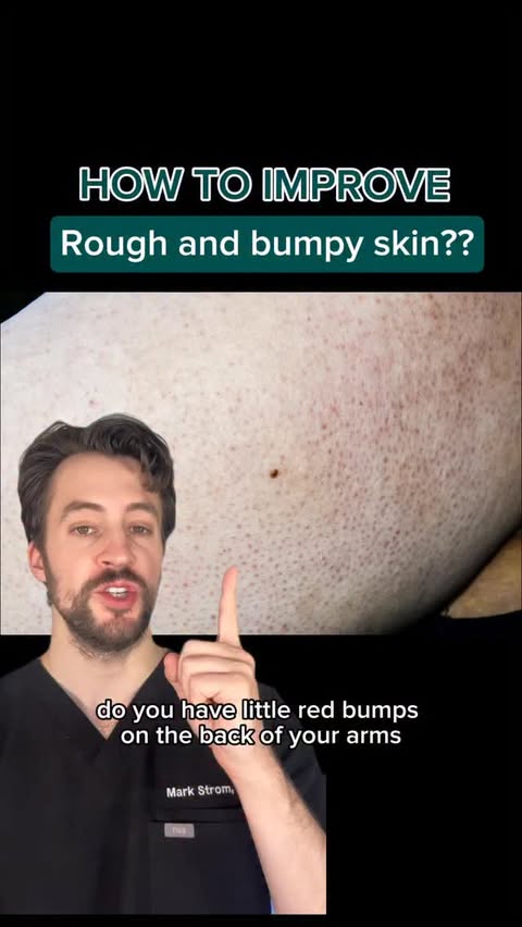Instagram post by @dermarkologist for ATOPALM. Caption reads: ad How to improve rough and bumpy skin on the body....