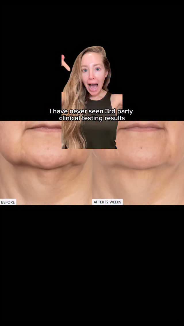 Instagram post by @jillian.gottlieb for Dr. Whitney Bowe Beauty. Caption reads: [...] my bio i’m so impressed with this....