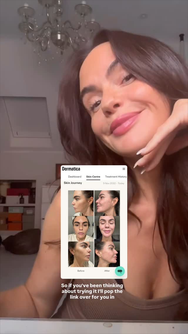 Instagram post by @missjenjomet for Dermatica. Caption reads: AD The best skincare secret I’ve stuck to 👀✨....