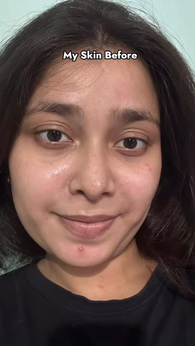 Instagram post by @charuuyy for Kapiva. Caption reads: ✨Want glowing skin? 🍉

Kapiva Skin Foods Glow Mix....