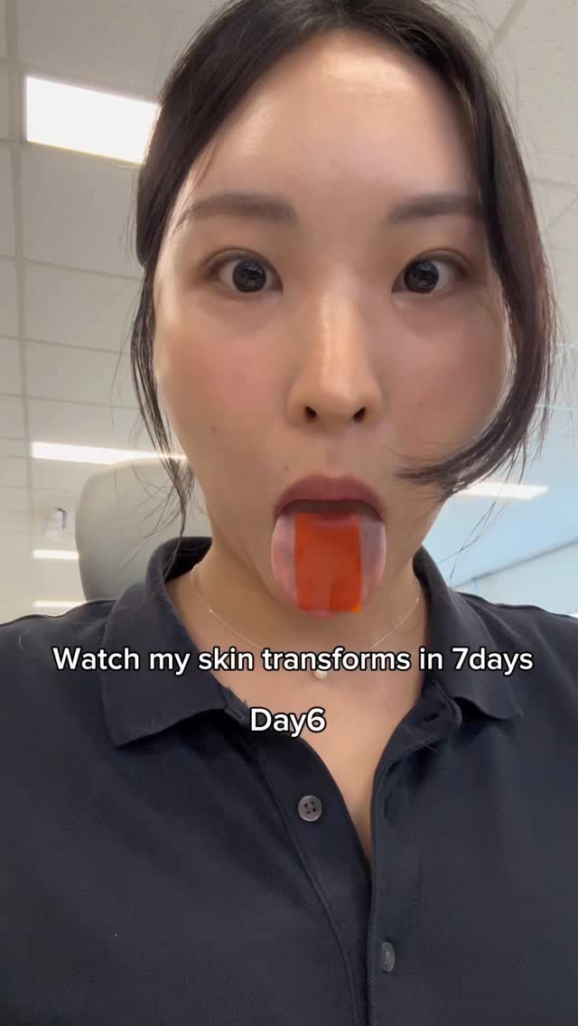 Instagram post by @skincare.zombie for Esther Formula. Caption reads: Skin transformation in 7days
With....