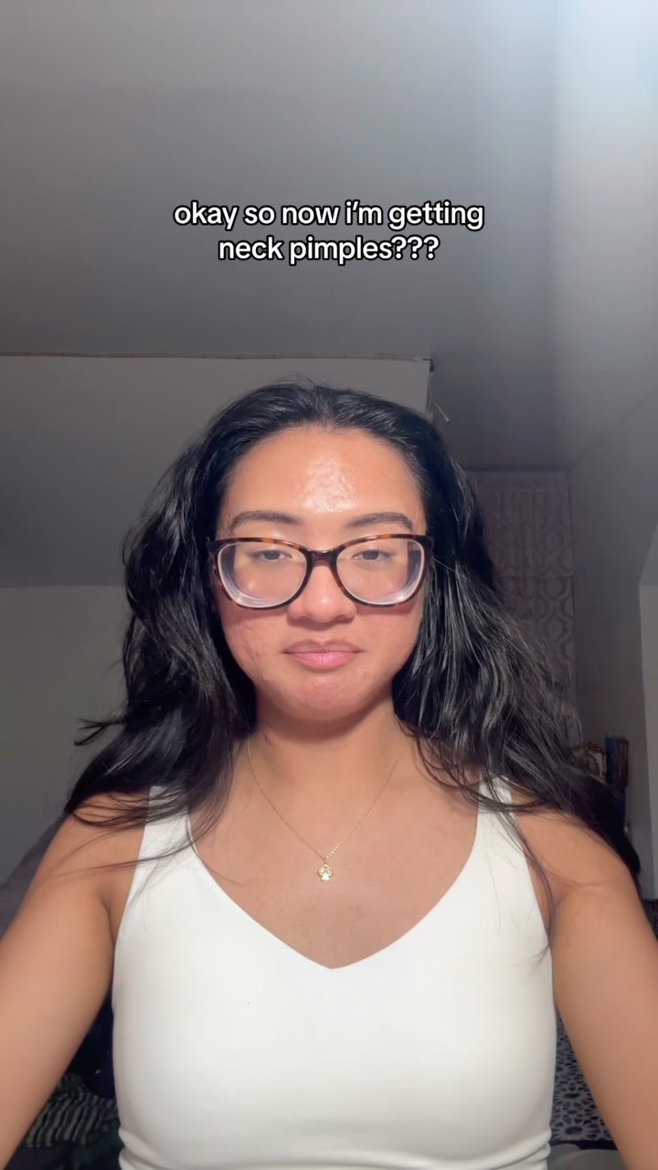 Instagram post by @thatacnegirlie for Peace Out Skincare. Caption reads: my fault, i didn’t notice that the camera didn’t....