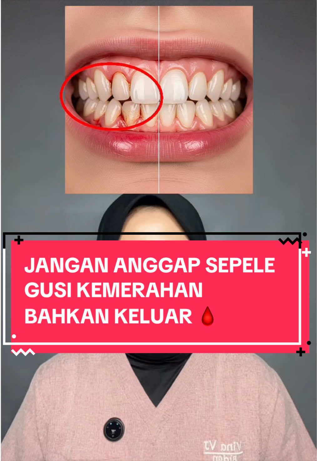 TikTok post by @bidanvinavj for Metoo Beauty. Caption reads: [...] jangan di anggap sepele ya wargaaa @Metoo....