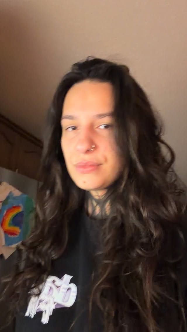 Instagram post by @romaarmyofficial for Removery. Caption reads: @removery is seriously the BEST clinic to go to,....