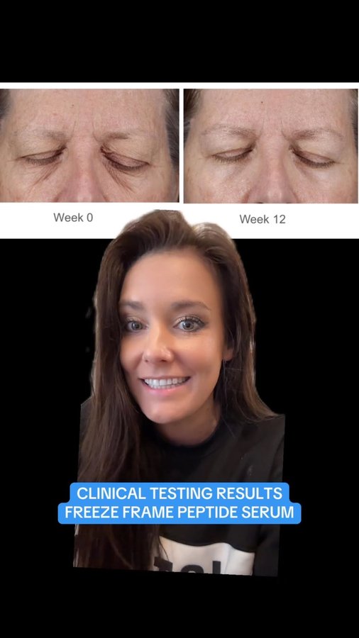 Instagram post by @alexeducatedmess for Educated Mess. Caption reads: [...] peptide serum) from my brand @educatedmess....