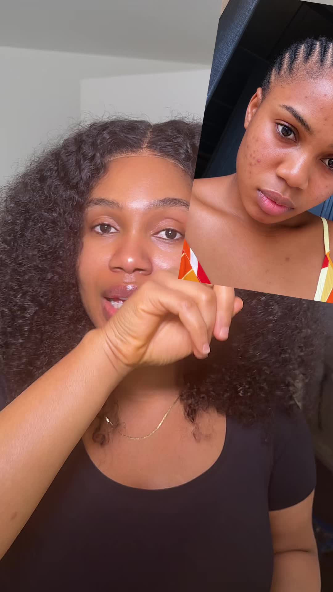 TikTok post by @phoeberhymes for Axis-y. Caption reads: [...] #darkspotremoval #skincare #fyp @AXISY UK.