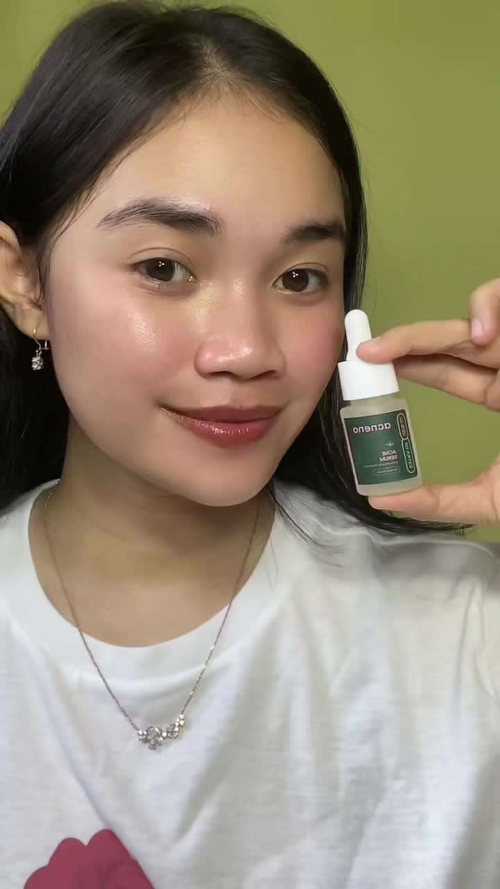 TikTok post by @putrinabila2023 for Acneno Indonesia. Caption reads: [...] andalan aku klo lagi breakout ya @Acneno....