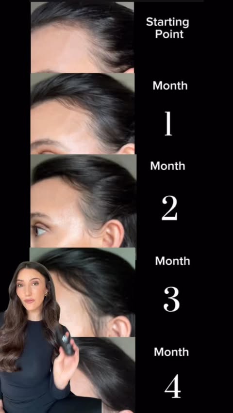 Instagram post by @brittanygolday for OneSkin. Caption reads: I can’t believe how much hair growth I’ve had in....