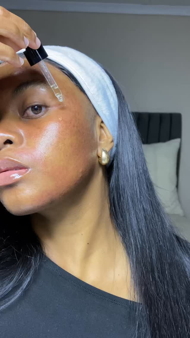 Instagram post by @simphiwee_mb for Banish. Caption reads: Your at-home microneedling might not be working....