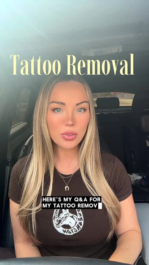 Instagram post by @kellykay for Removery. Caption reads: You asked, I answered! Tattoo removal Q&A with....