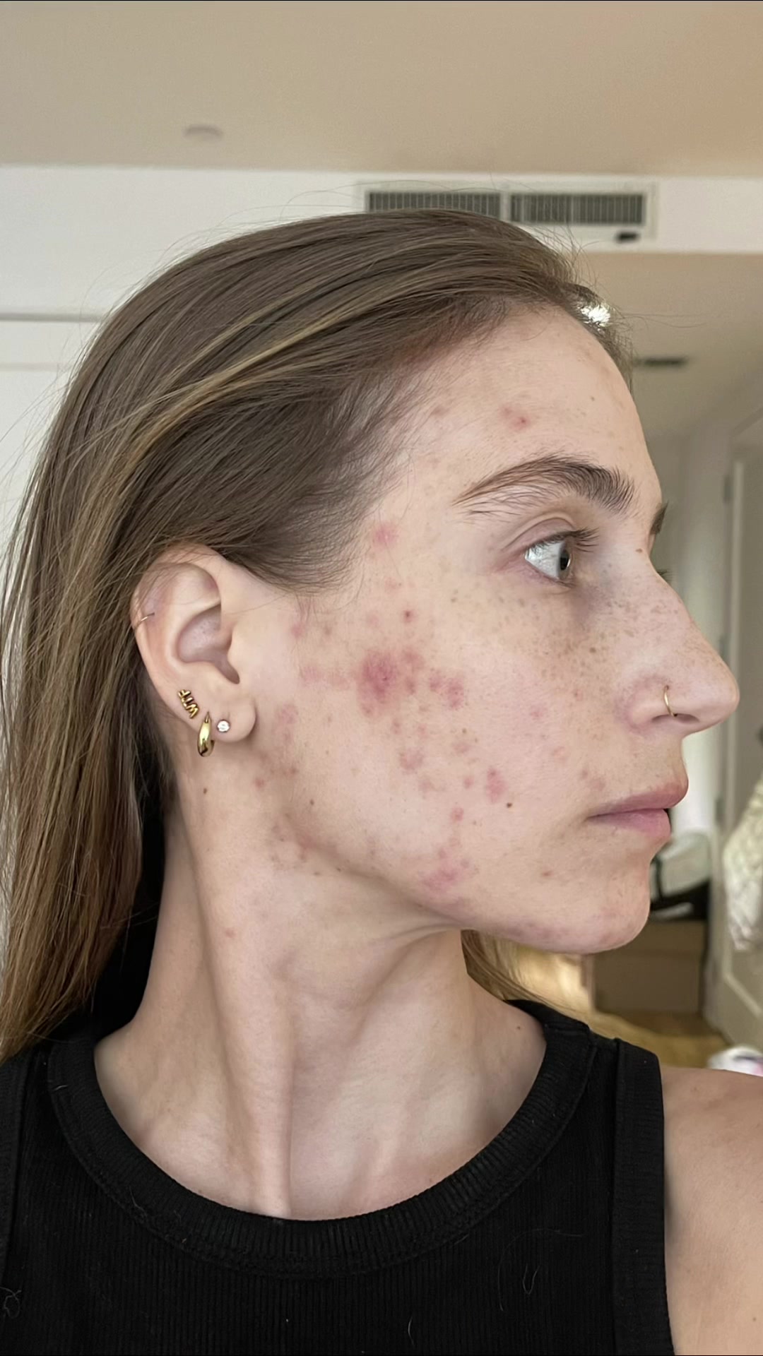 TikTok post by @amandabatula for Face Reality. Caption reads: [...] for where my skin is today thanks to @Face....