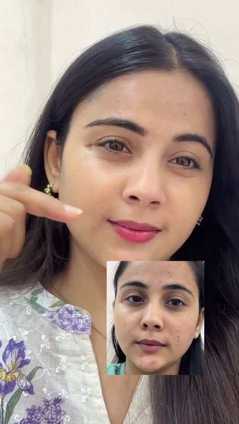 Instagram post by an influencer for WildGlow Skincare. Caption reads: Comment “LINK” to grab yours now! or you can send....