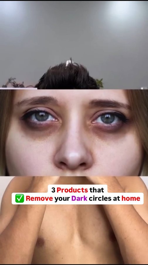 Instagram post by @viratsinghh.08 for The Ayurveda Co.. Caption reads: ✅ Reduce DARK CIRCLES at HOME!
.
@theayurvedaco....