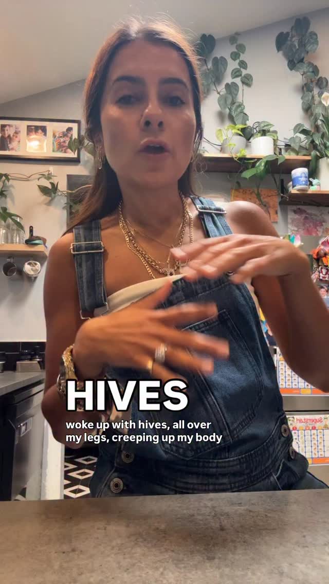 Instagram post by @healingfromtheinsidenout for Vimergy. Caption reads: [...] 2 hours later no itch, no hives. I use....