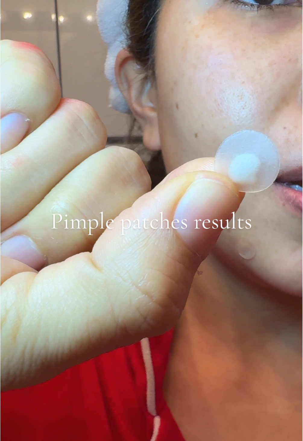 TikTok post by @monicaramos_va for PatchRx. Caption reads: My go to pimple patches are always from @PatchRX....