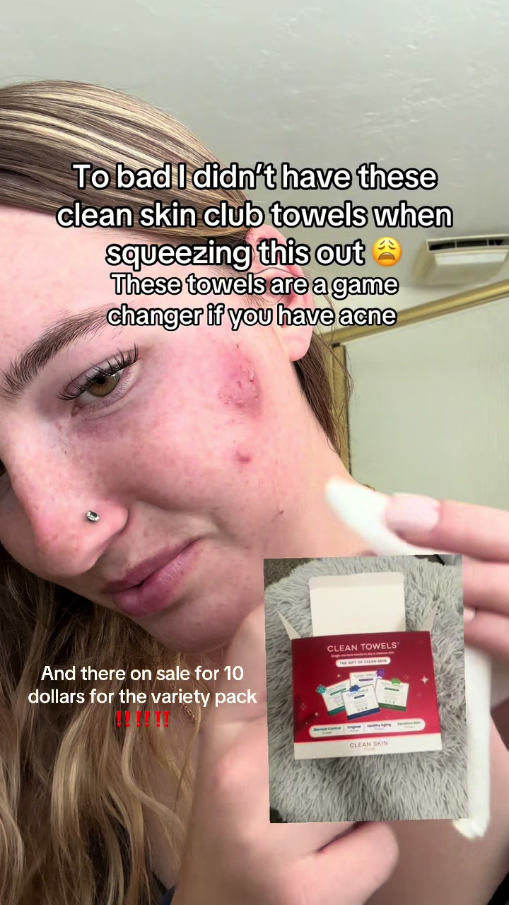 TikTok post by @chelsea_surls_ for cleanskinclub. Caption reads: [...] skin it has cleared my acne so much....