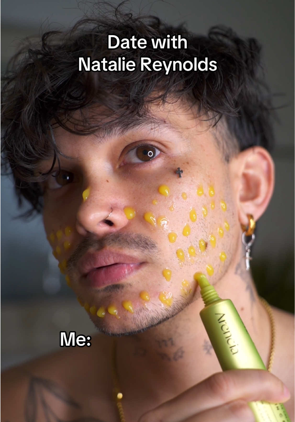 TikTok post by @joshuamonis for arencia. Caption reads: Anzeige| No more acne with @Arencia ❤️ #arencia....