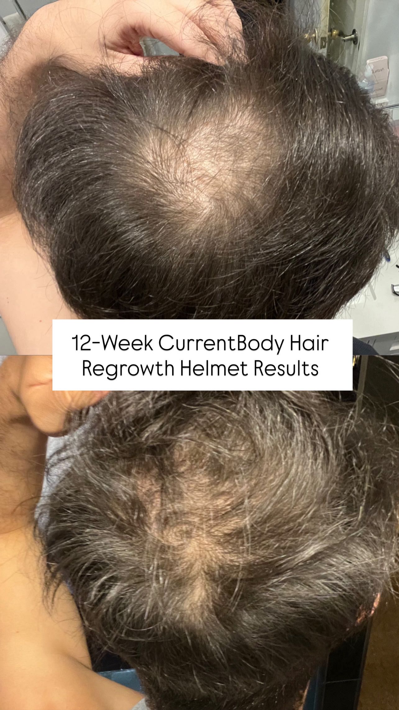 Instagram post by @maximumskin for CurrentBody. Caption reads: @currentbody hair regrowth helmet update 😭

I’m....