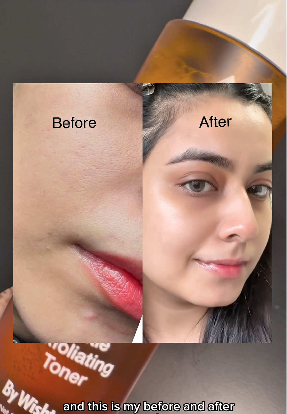 TikTok post by @asraqasim_ for ByWishtrend. Caption reads: [...] skin with gentle exfoliating toner . ....