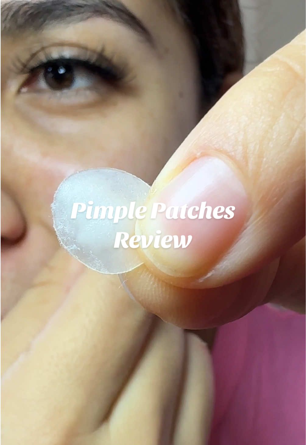 TikTok post by @monicaramos_va for PatchRx. Caption reads: [...] thanks to these pimple patches @PatchRX....