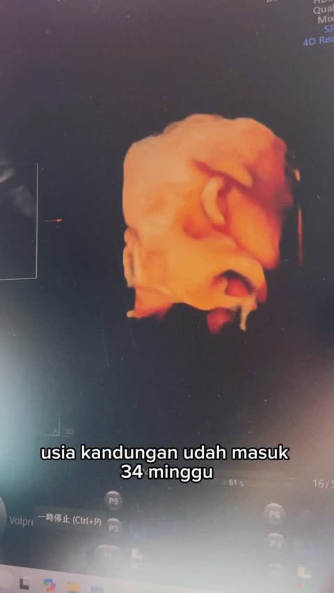 Instagram post by @kikikarenn for Mom Uung. Caption reads: [...] hamil, istriku minum Mylkflow dari....