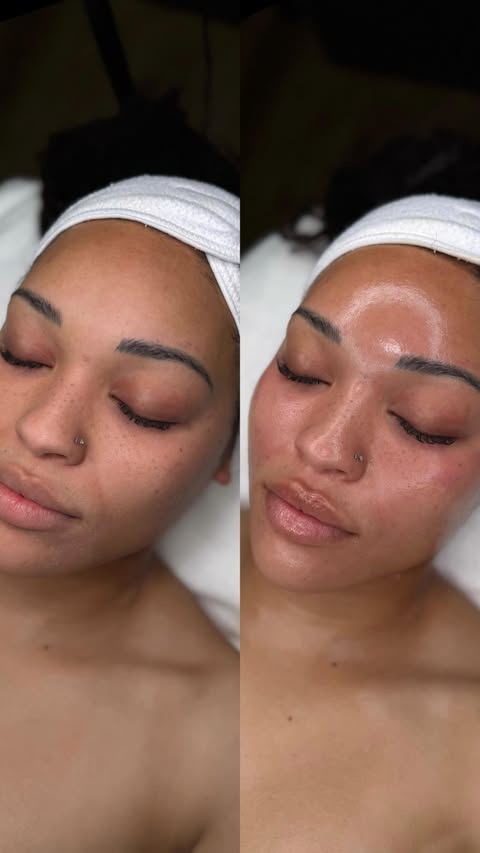 Instagram post by @skinwithcass for Hydrafacial. Caption reads: [...] time to reset your skin with a Hydrafacial!....
