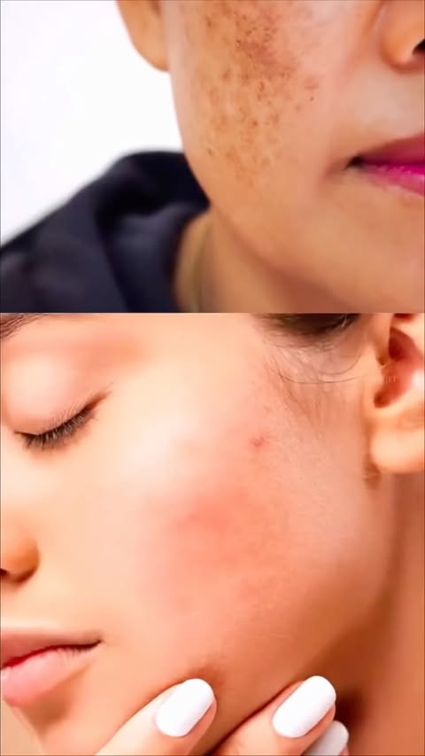 Instagram post by @tk_tamilan_ for Chicnutrix. Caption reads: [...] #skincare #skinglow #glowingskincare....