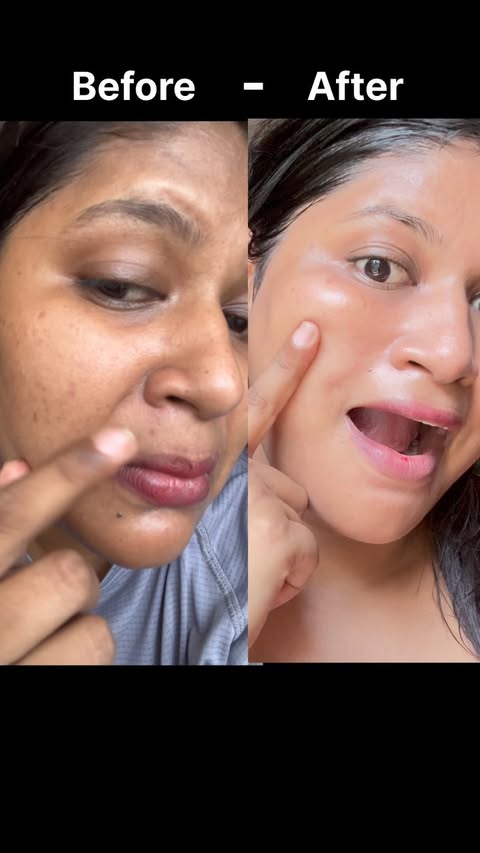 Instagram post by an influencer for The Derma Co. Caption reads: [...] #bestserumfprclearskin @thedermacoindia.