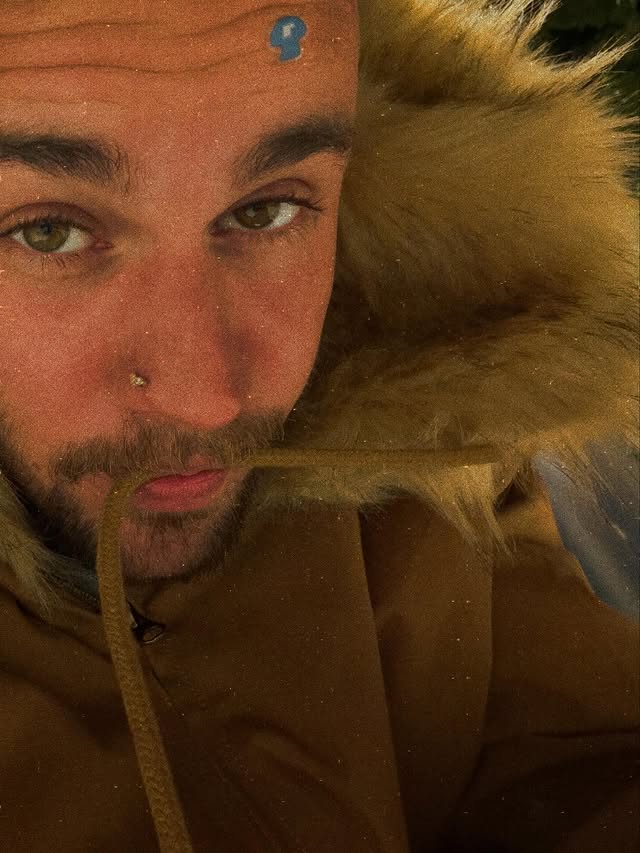 Instagram post by @lilbieber for Rhode Skin. Caption reads: Tokyo photo dump with the new @rhode

Blemish....