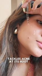 Instagram post by @lifeasgayanthika for The Ayurveda Co.. Caption reads: Banish Acne & Dark Spots Naturally – One Serum,....