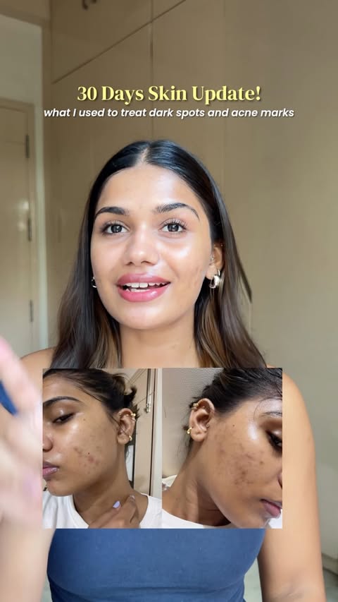 Instagram post by @vridhijhanwar for Asaya. Caption reads: [...] spots fade with consistent use!!....