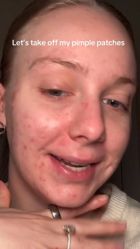 Instagram post by @thatkaitysmith for Axis-y. Caption reads: [...] healthy, resilient skin. This....