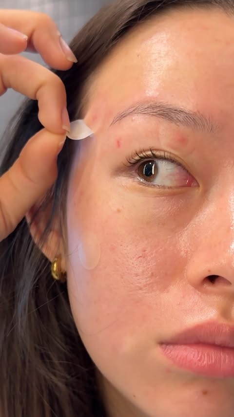 Instagram post by @_mollyfaye for Hero Cosmetics. Caption reads: [...] 20x more painful iykyk.. that’s why....