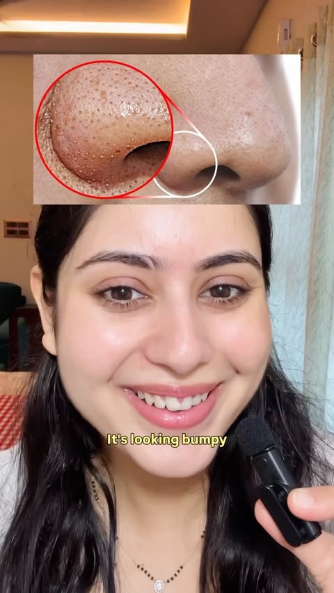 Instagram post by @bhartiparajuli1066 for Conscious Chemist. Caption reads: [...] pores and smoother-looking skin 💚....