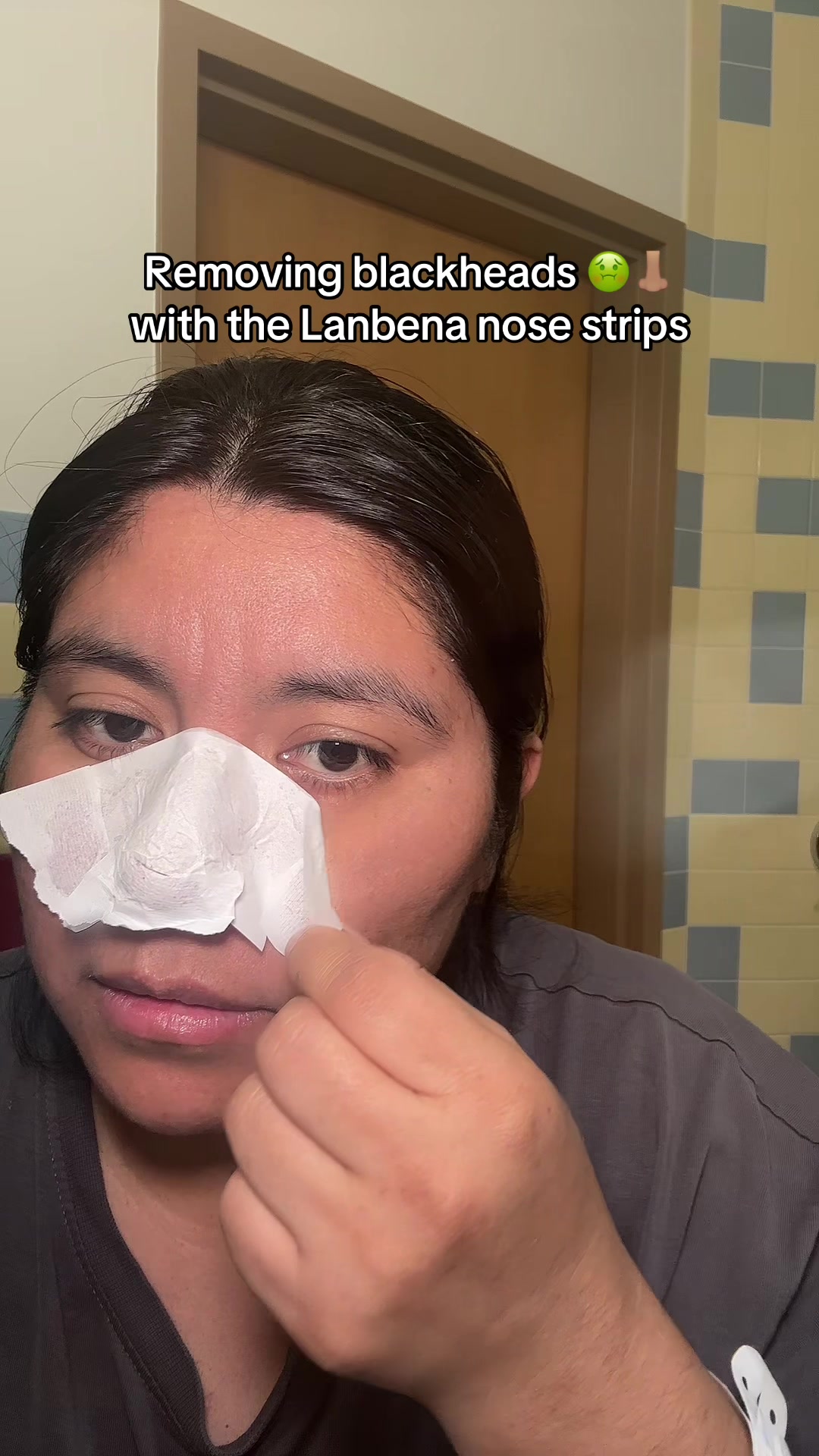 TikTok post by @yoanawfhm for Lanbena. Caption reads: Lanbena blackhead remover actually works!! [...].
