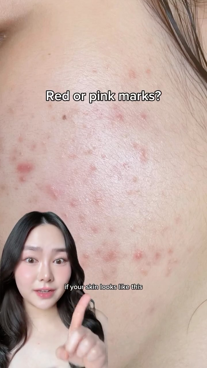 Instagram post by @jasmineflowerable for Jumiso. Caption reads: This Korean dark spot remover did not fail to....